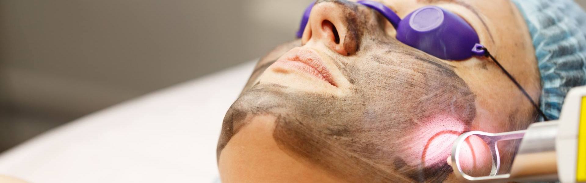 Laser Skin Rejuvenation Berkhamsted Koha Main Feature Image