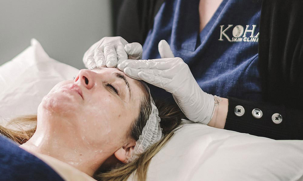 Microneedling Have You Tried Micro-Needling – Here is Why You Should Blog Image